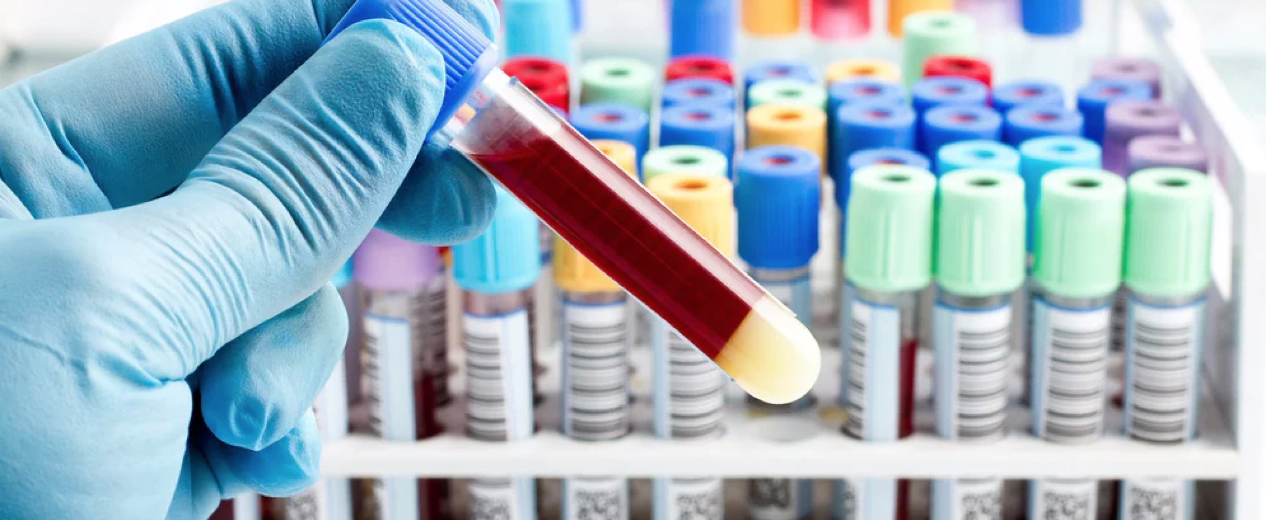 Gloved hand holding a blood vial